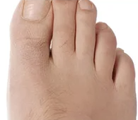 Крем від «кісточки» на великому пальці